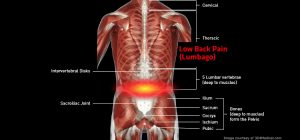 Back_LowBackPain_large