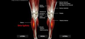 Legs_ShinSplints_large